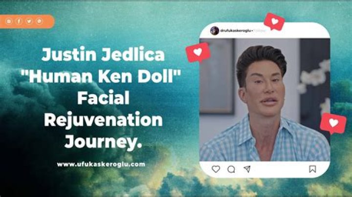 Human Ken Doll Justin Jedlica Gives Plastic Surgery Update – Hollywood Life